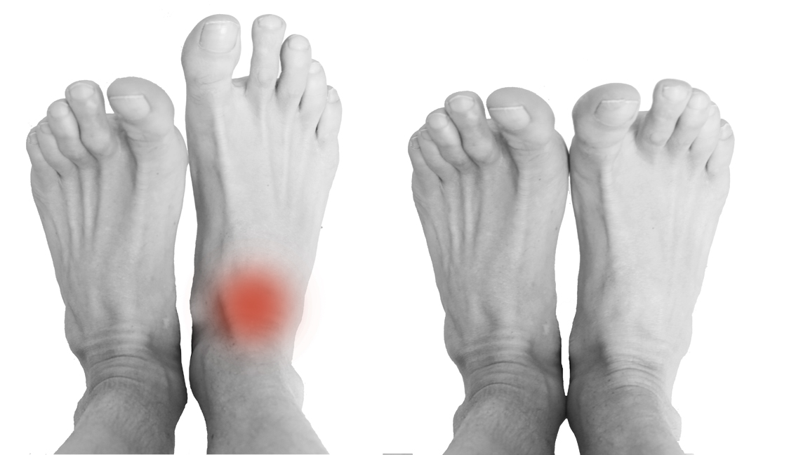 Rebouteux Douleurs de la cheville - Douleurs du pied