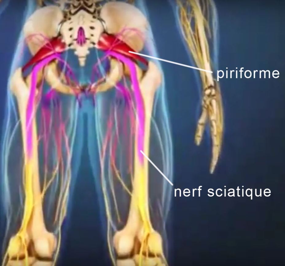 rebouteux sciatique, piriforme et sciatique